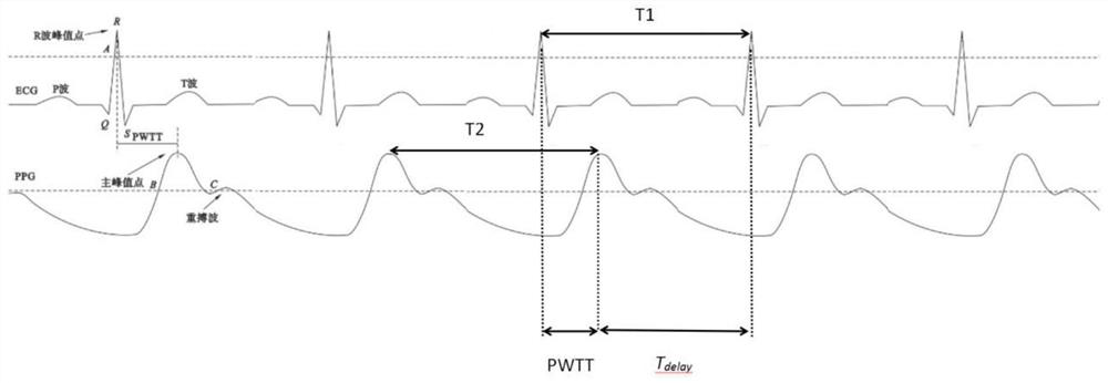 A wearable device and a magnetic resonance electrocardiogram gating system based on the wearable device