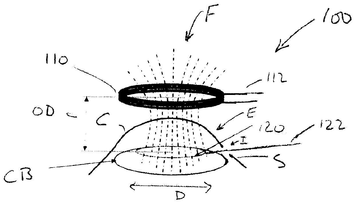 Capsulotomy device and method using electromagnetic induction heating