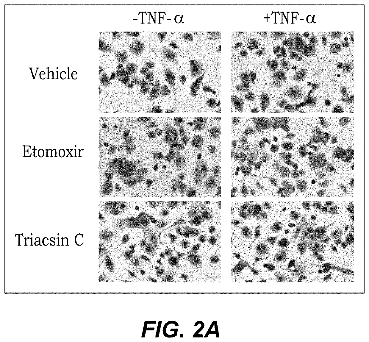 Method of treating postprandial inflammation and preventing weight gain