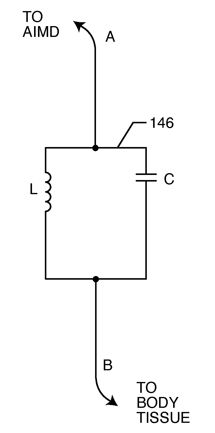 Band stop filter employing a capacitor and an inductor tank circuit to enhance MRI compatibility of active implantable medical devices