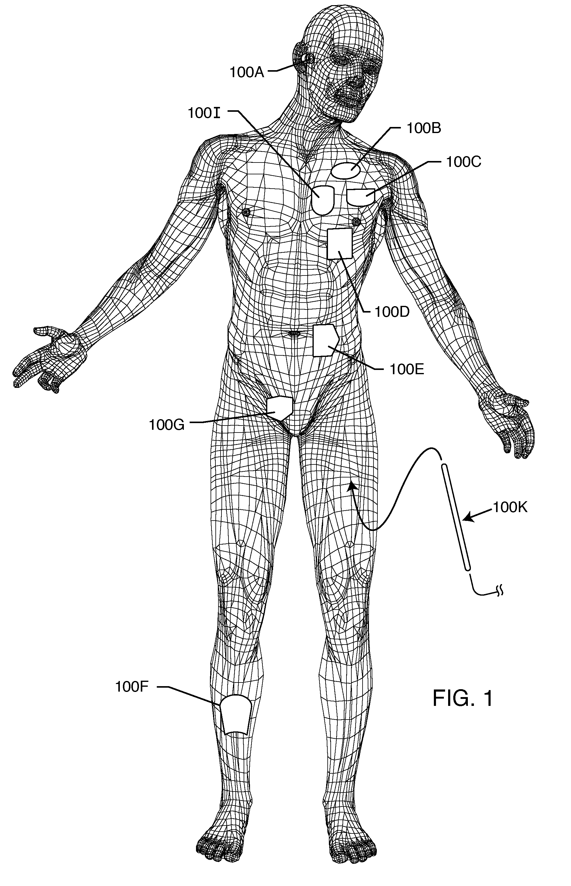 Band stop filter employing a capacitor and an inductor tank circuit to enhance MRI compatibility of active implantable medical devices