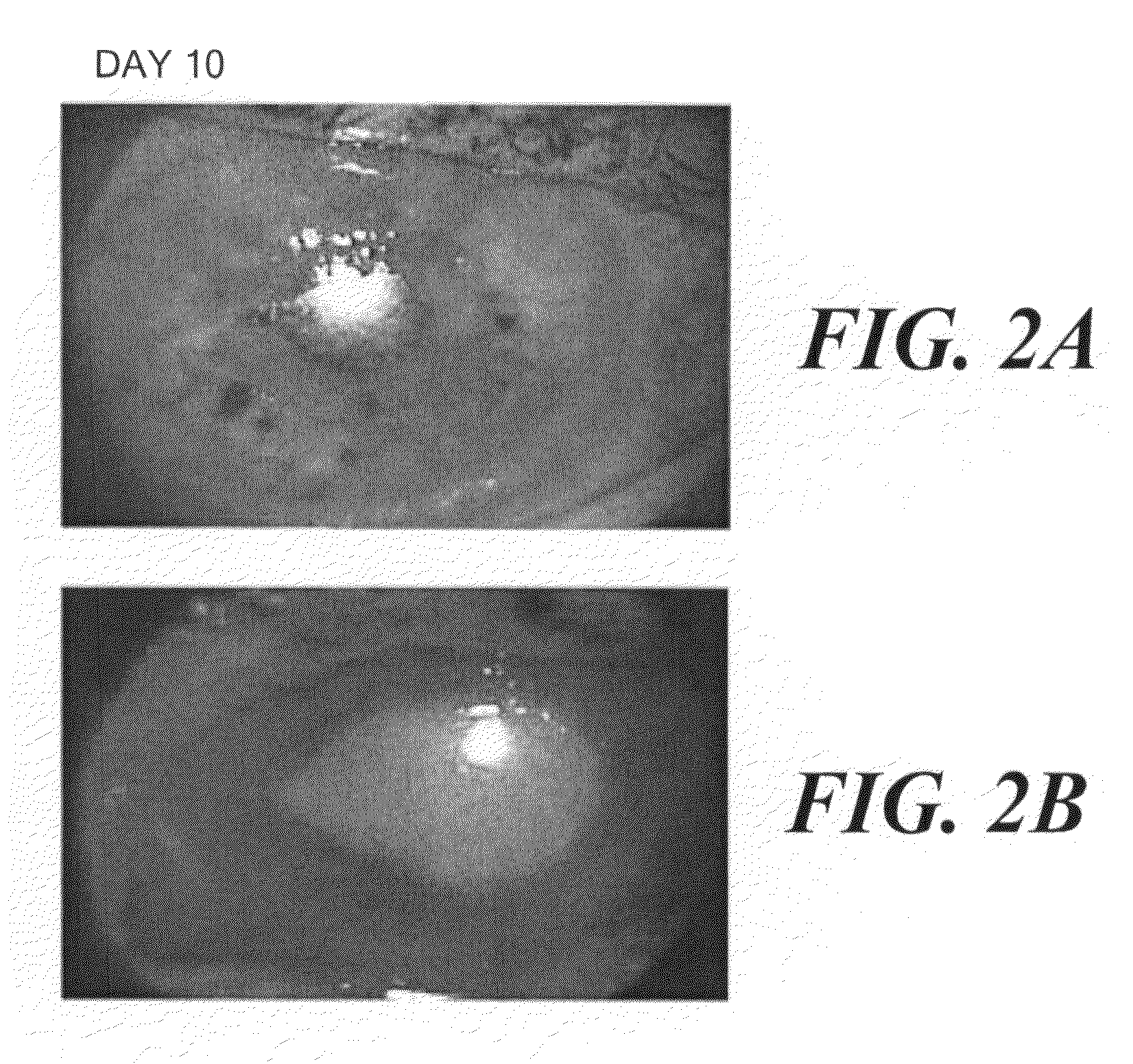 Use of a human amniotic membrane composition for prophylaxis and treatment of diseases and conditions of the eye and skin