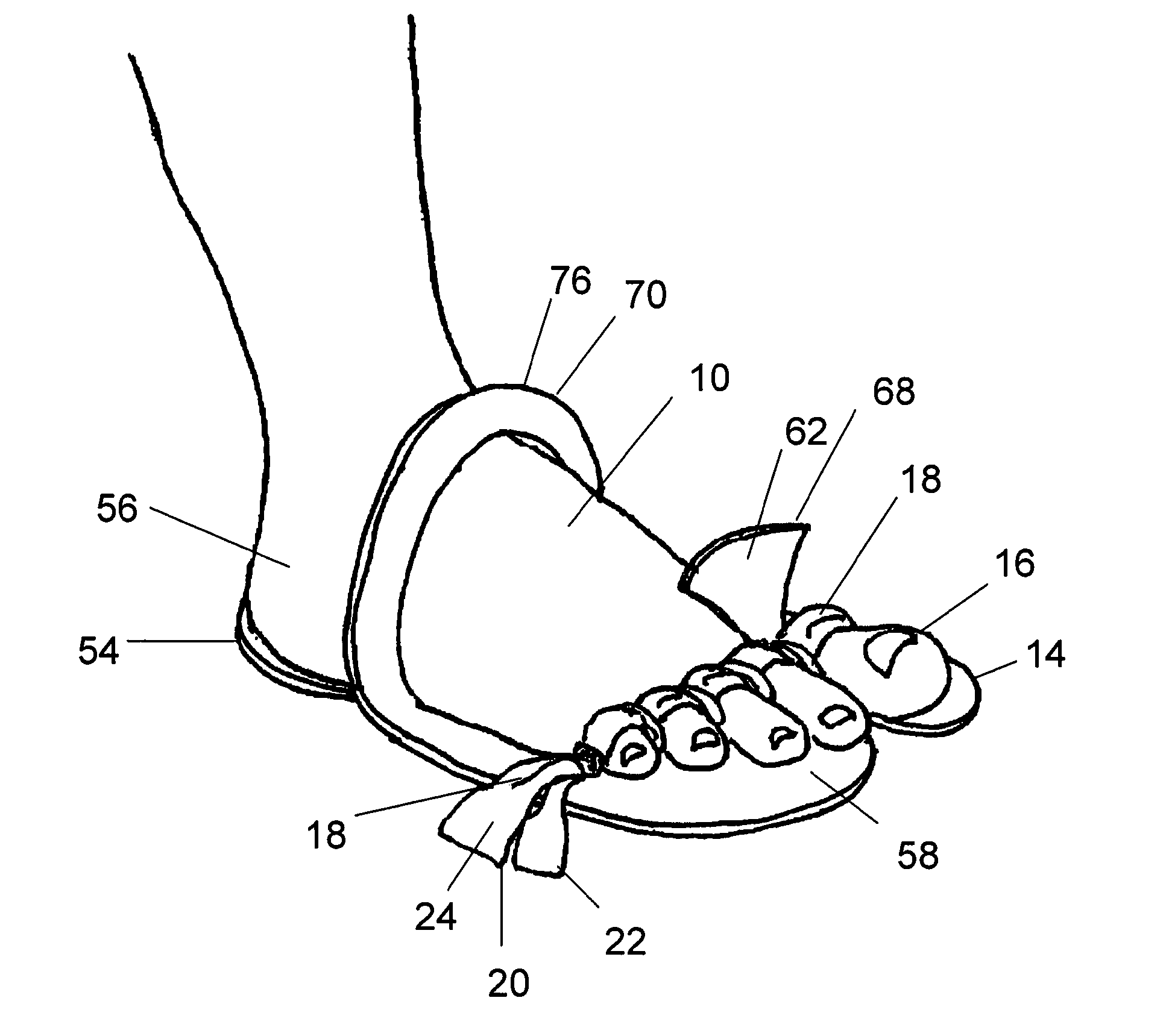 Pedicure Slipper with Toe Separator and Method