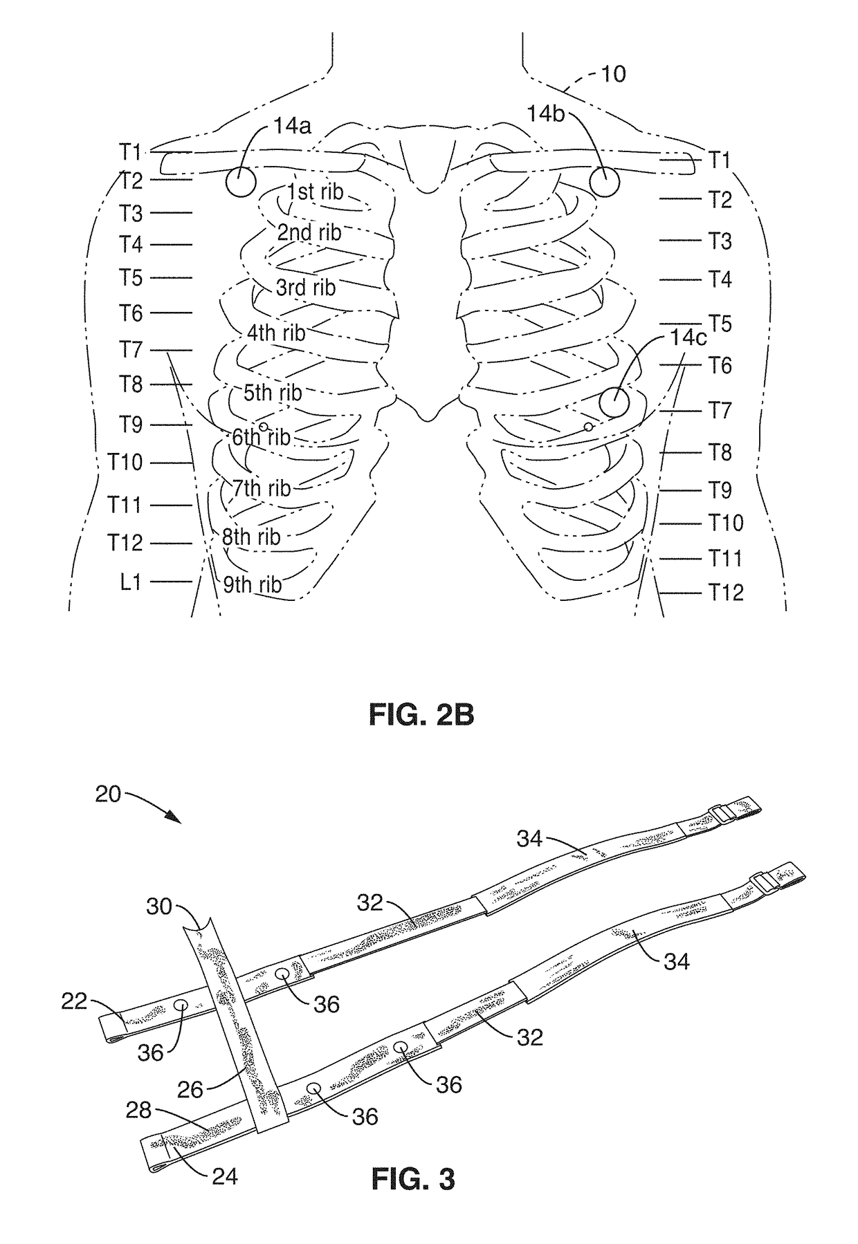 Multisensor cardiac function monitoring and analytics systems