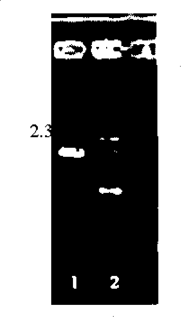 Recombined bifidobacteria hRV-VP4 expression vector and oral administration vaccine thereof