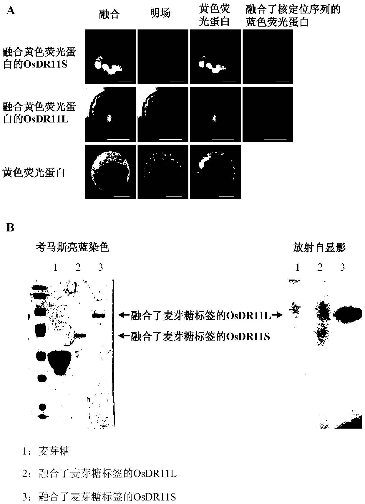 Rice disease resistance-related gene osdr11 and its application in rice disease resistance