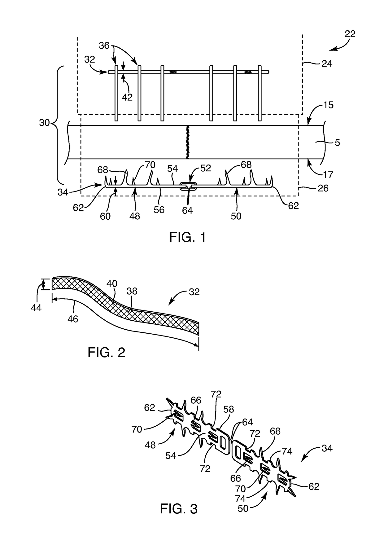 Devices, systems, and methods for repairing soft tissue and attaching soft tissue to bone