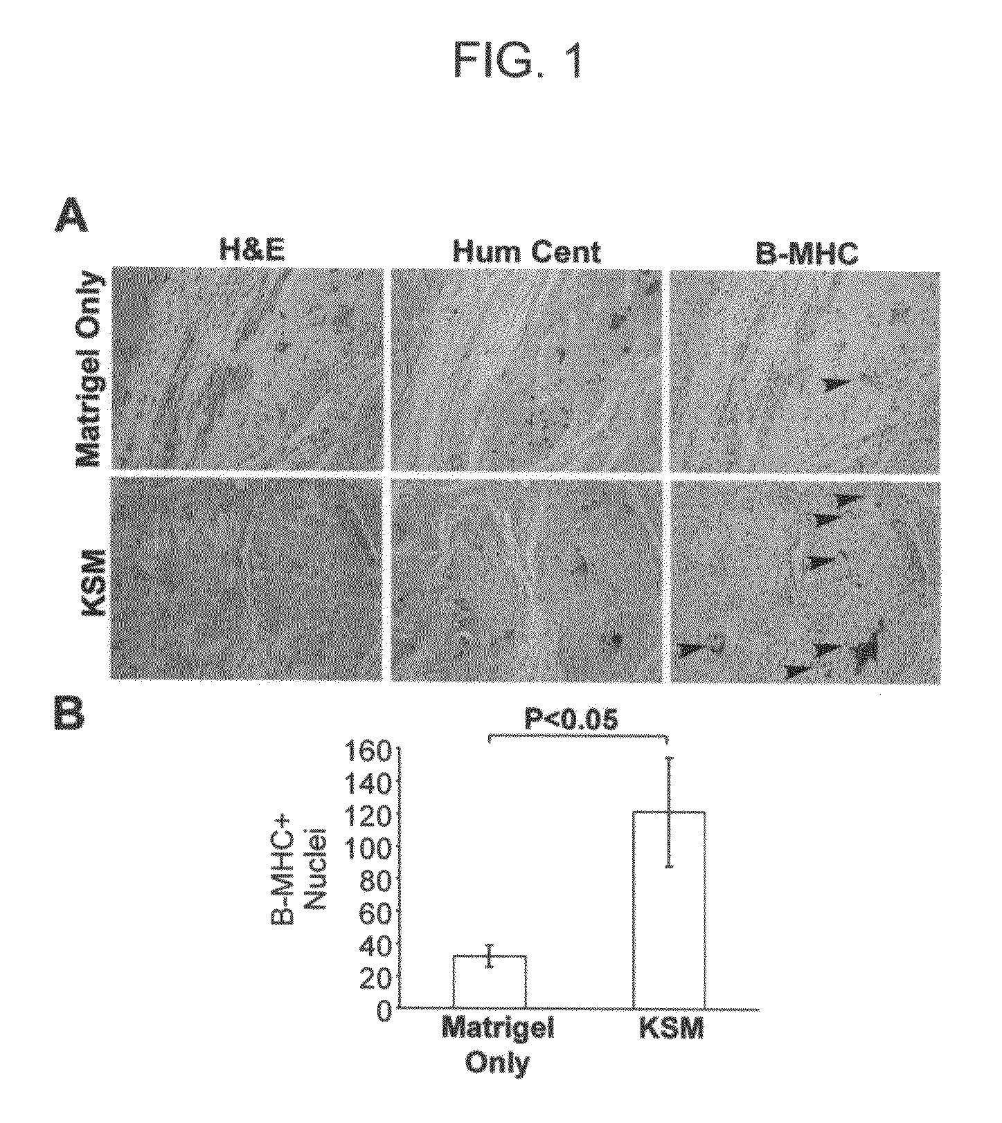 Formulation to improve survival of transplanted cells