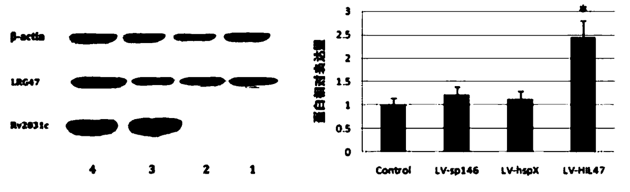 Tuberculosis vaccine and preparation technology thereof