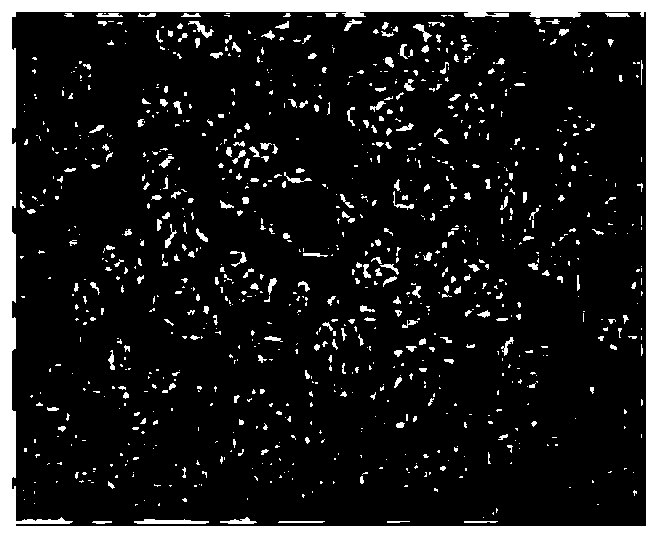 Chinese herbal compound particle for treating radiation-induced lung injury and preparation method thereof