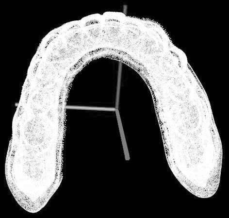 Gingival line automatic extraction method based on digital tooth model