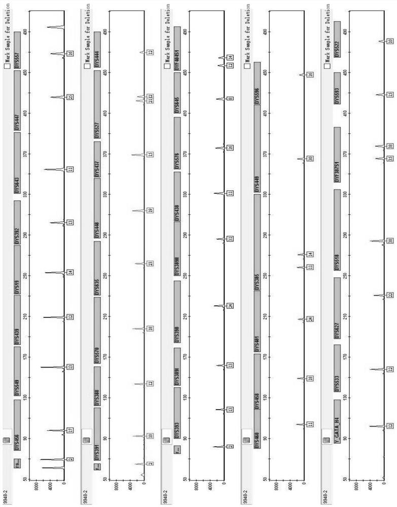 44 composite amplification kits and applications of human Y chromosome gene seats