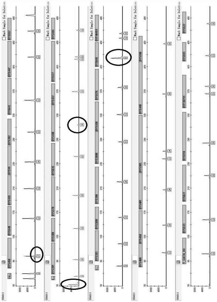 44 composite amplification kits and applications of human Y chromosome gene seats