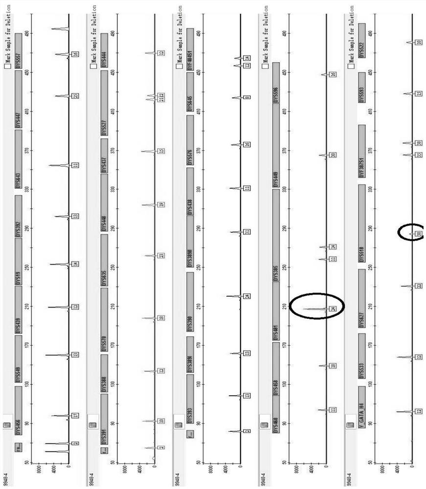 44 composite amplification kits and applications of human Y chromosome gene seats