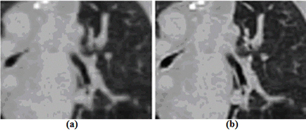 Super-resolution reconstruction method of lung 4D-CT images based on registration