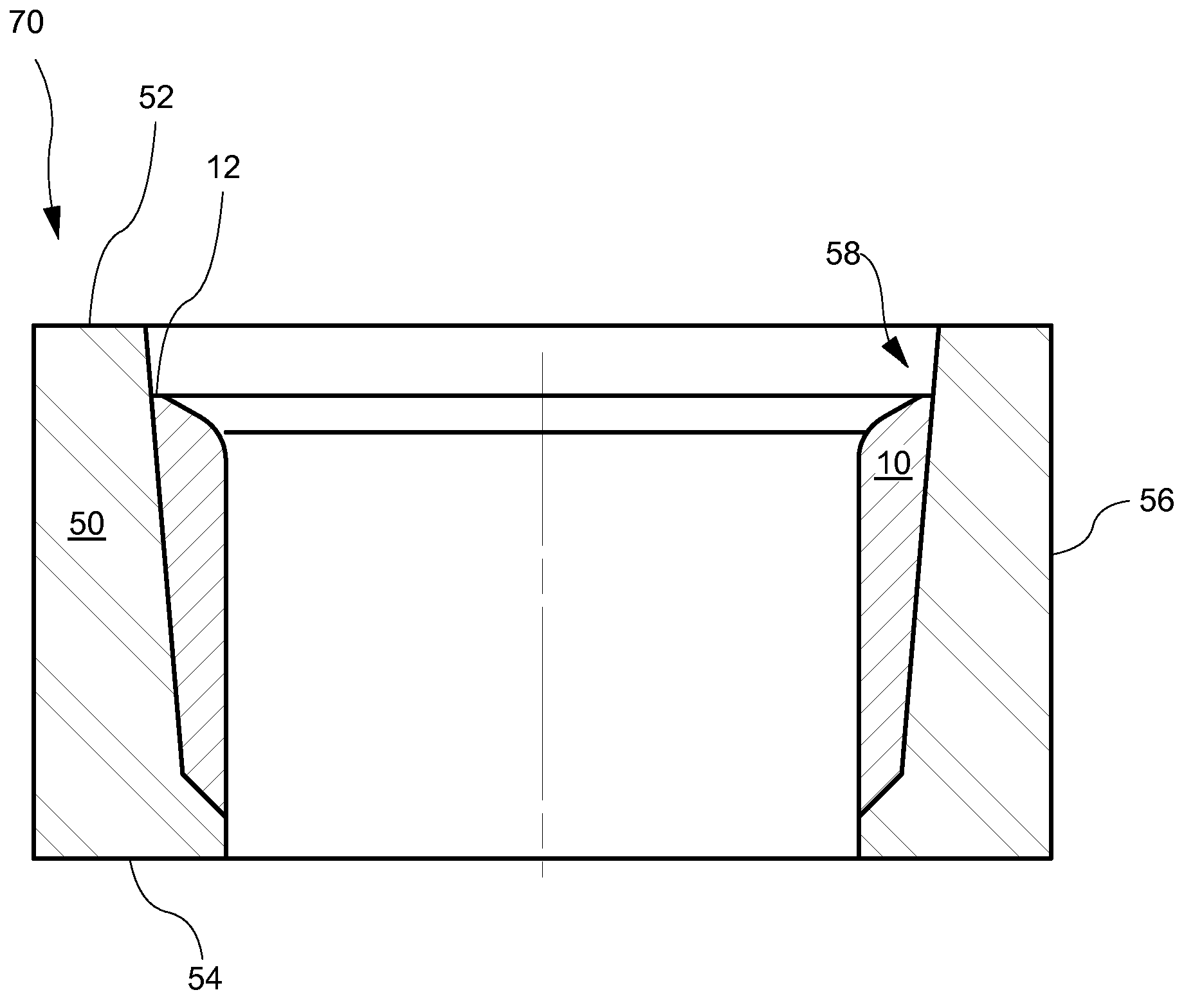 Powdered metal inlay