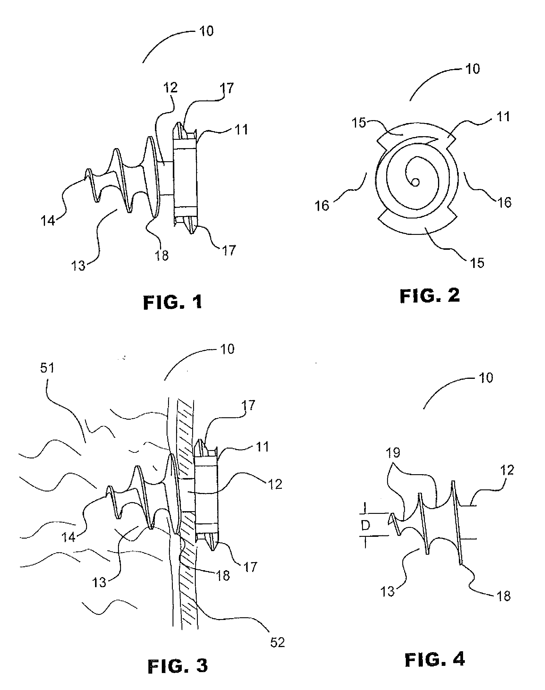 Absorbable anchor for hernia mesh fixation