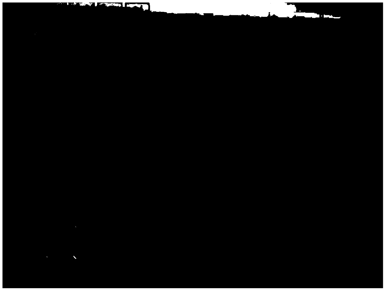 Preparation method of beta2-microglobulin monoclonal antibody