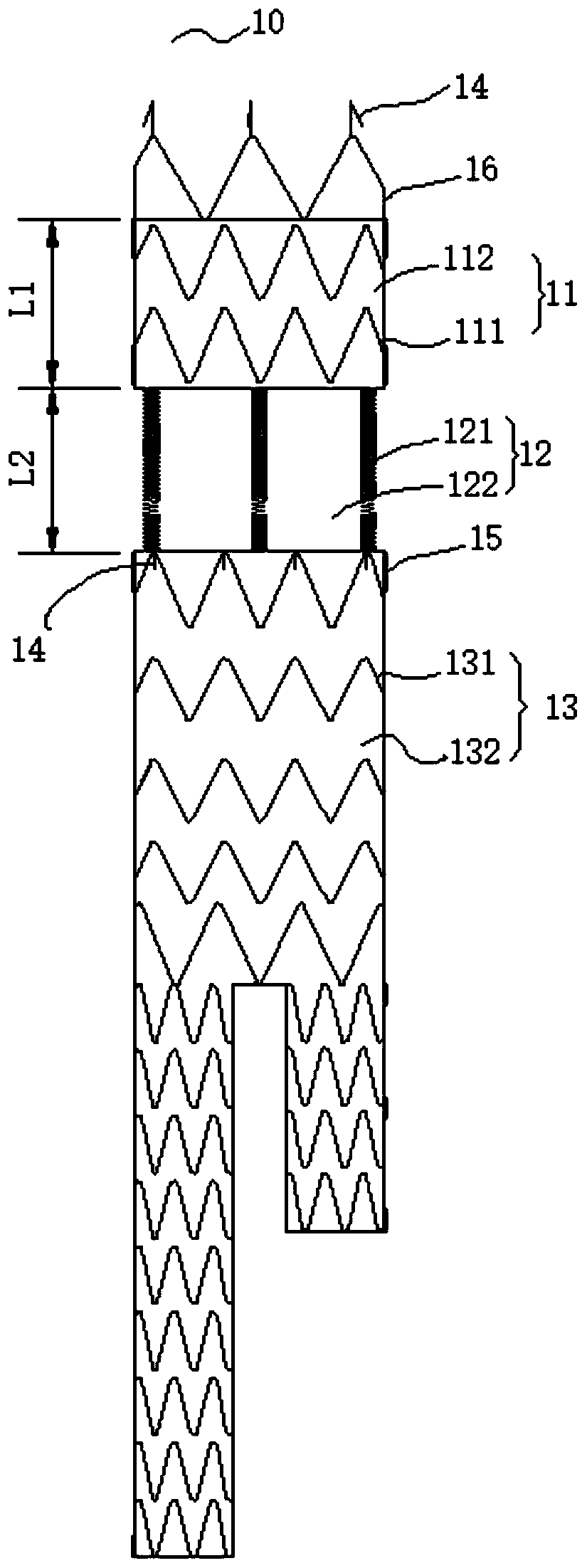 Covered stent