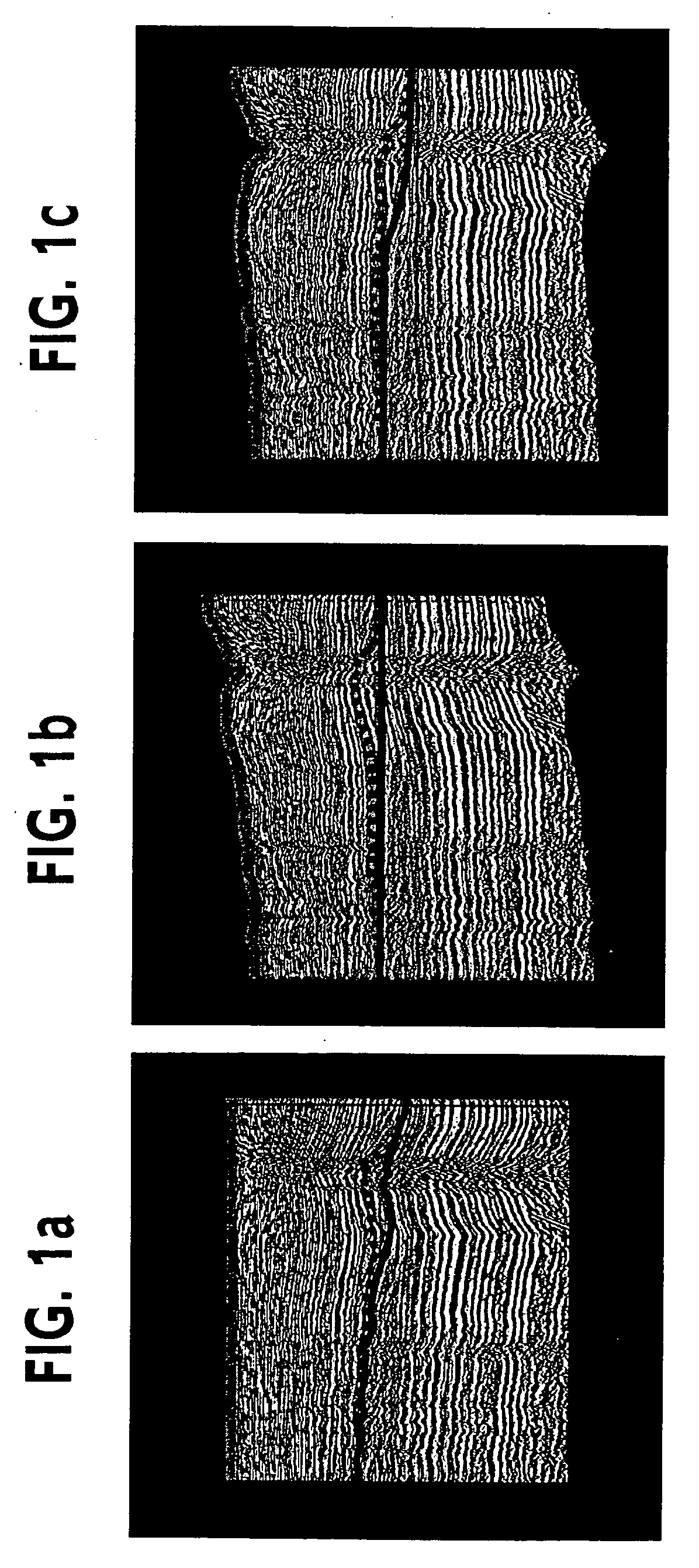 Seismic image deformation method for improved interpretation