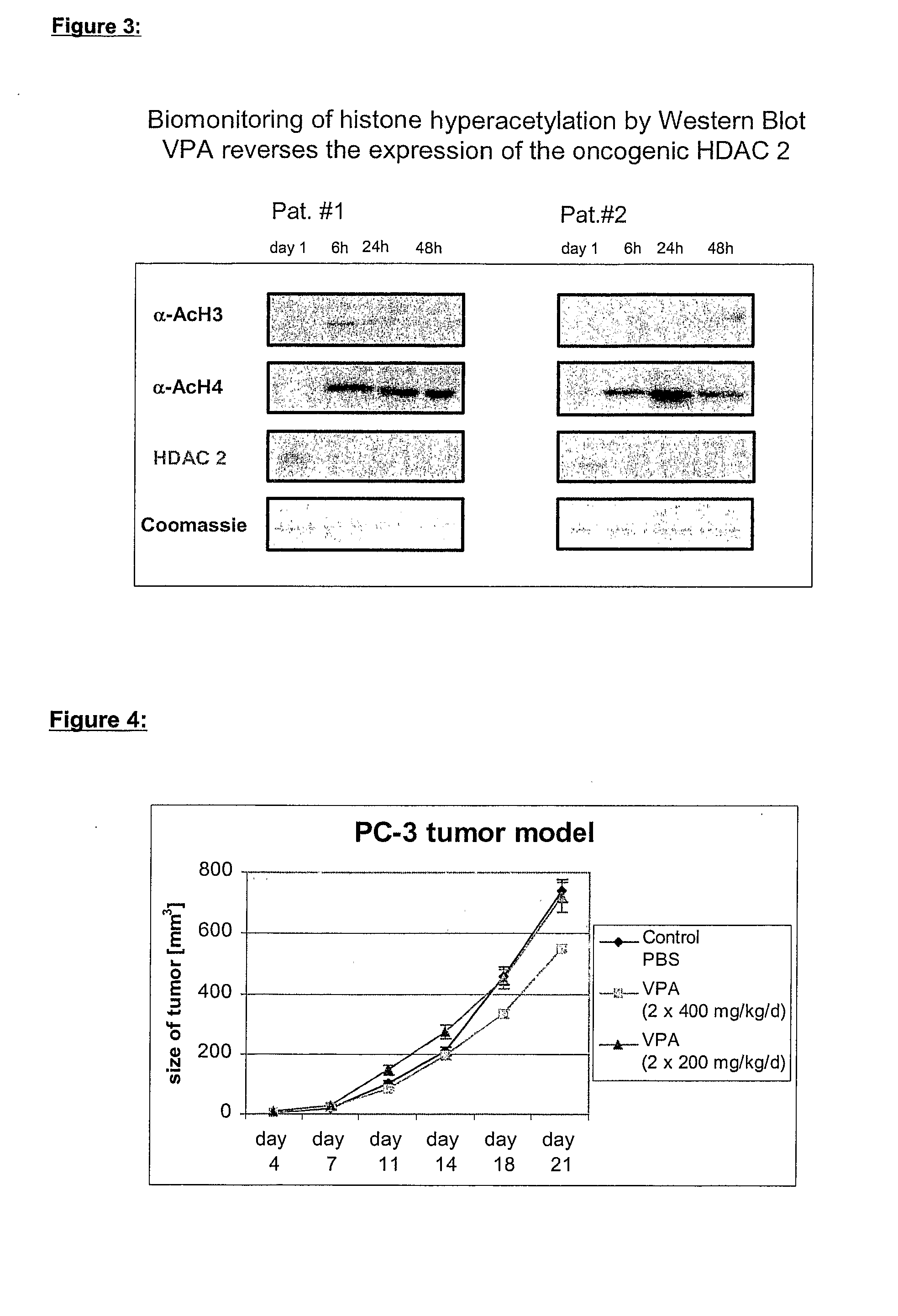 Formulation comprising histone deacetylase inhibitors