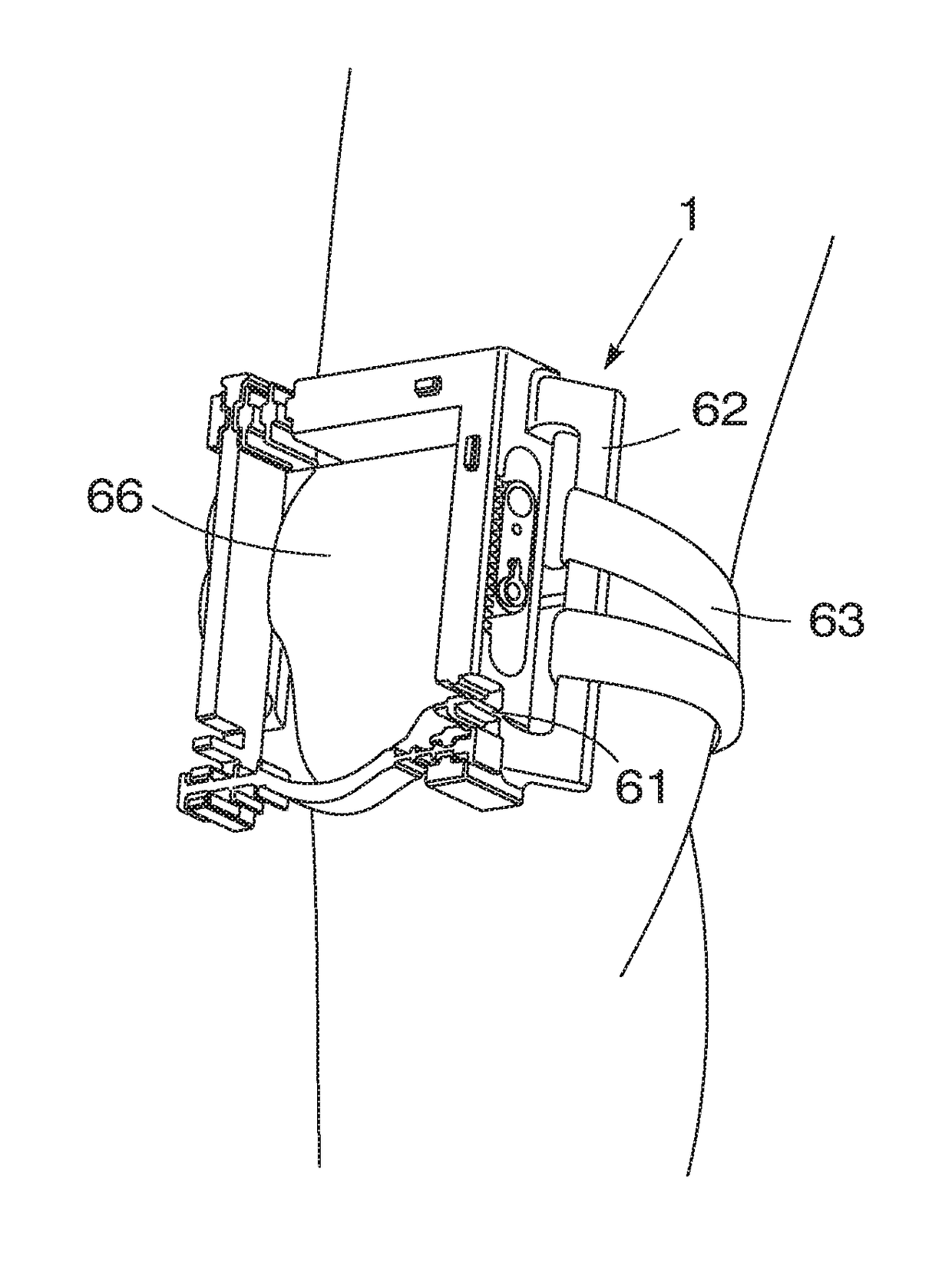 Accessory for conducting patella surgery