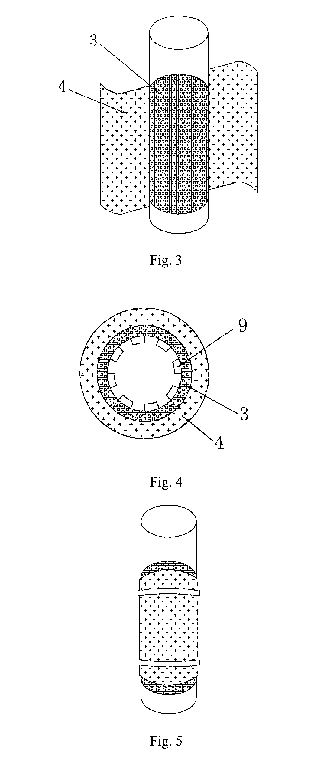 Methods and devices for in-situ treatment of sediment simultaneous with microbial electricity generation