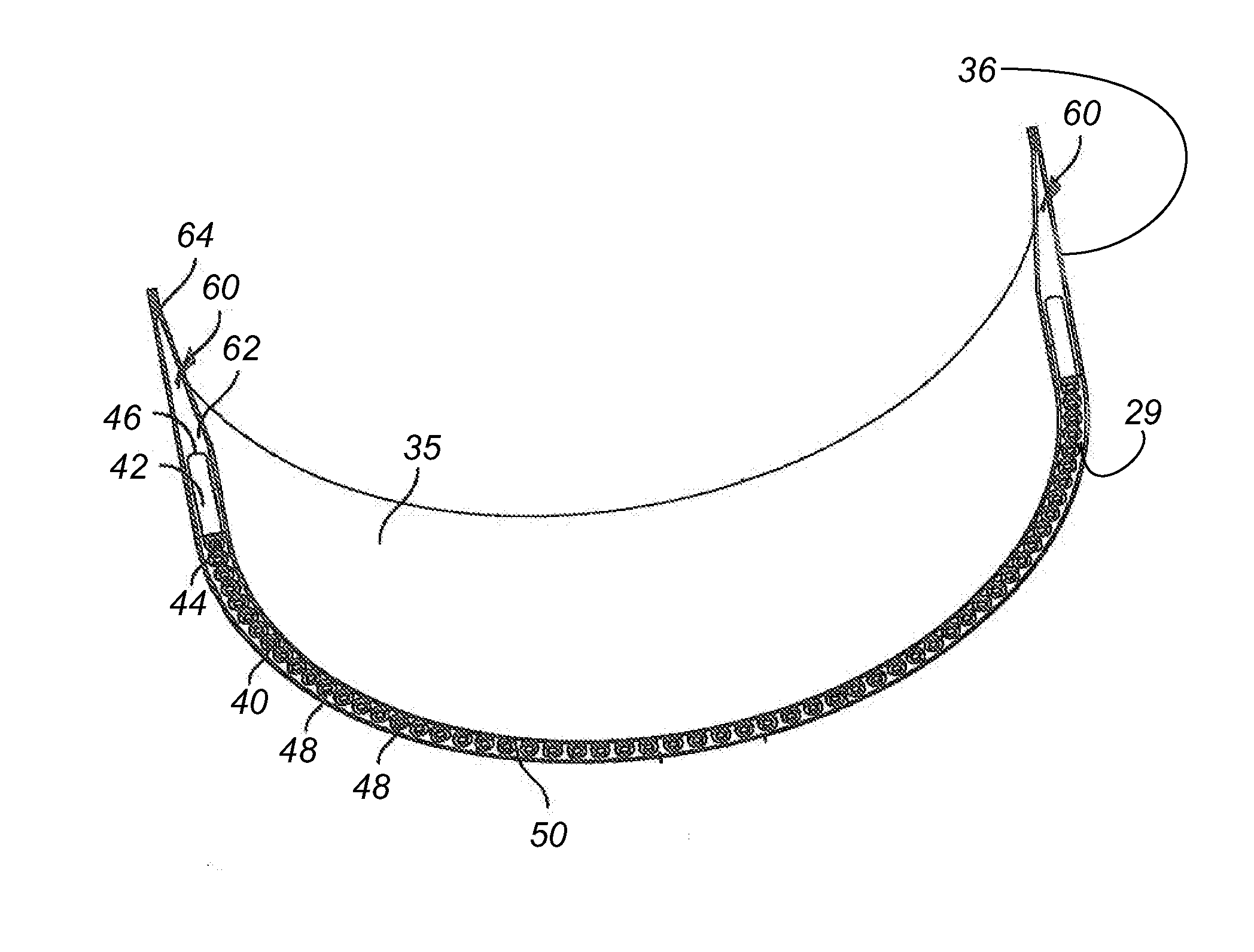 Wind Turbine Blade Bushing System