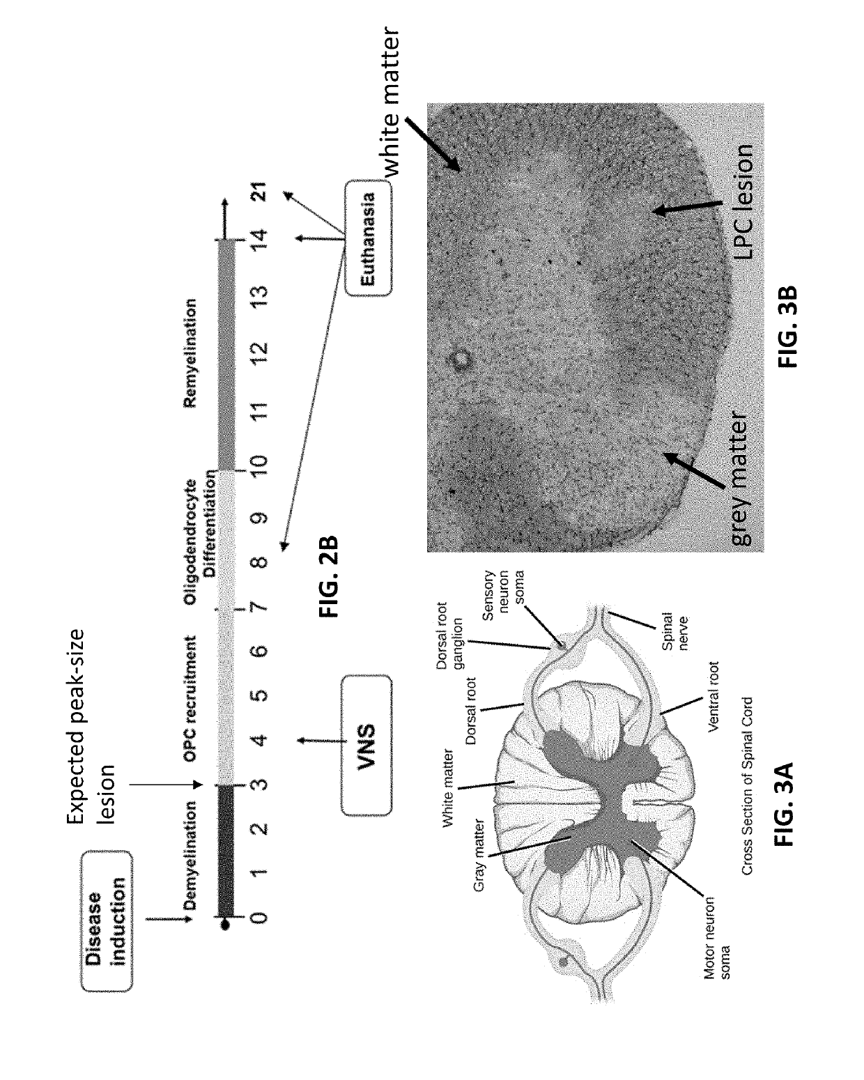 Vagus nerve stimulation to treat neurodegenerative disorders