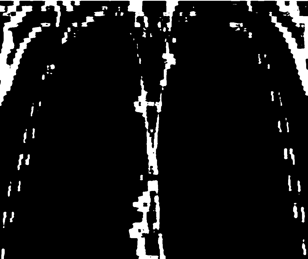 Method for reconstruction of super-resolution coronary sagittal plane image of lung 4D-CT image based on motion estimation