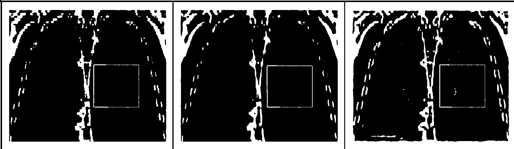 Method for reconstruction of super-resolution coronary sagittal plane image of lung 4D-CT image based on motion estimation