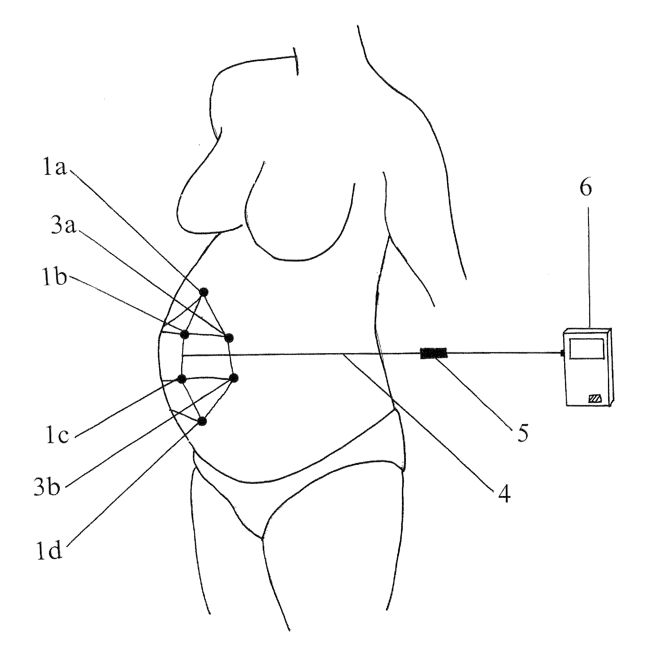 System and Method for Analyzing Progress of Labor and Preterm Labor