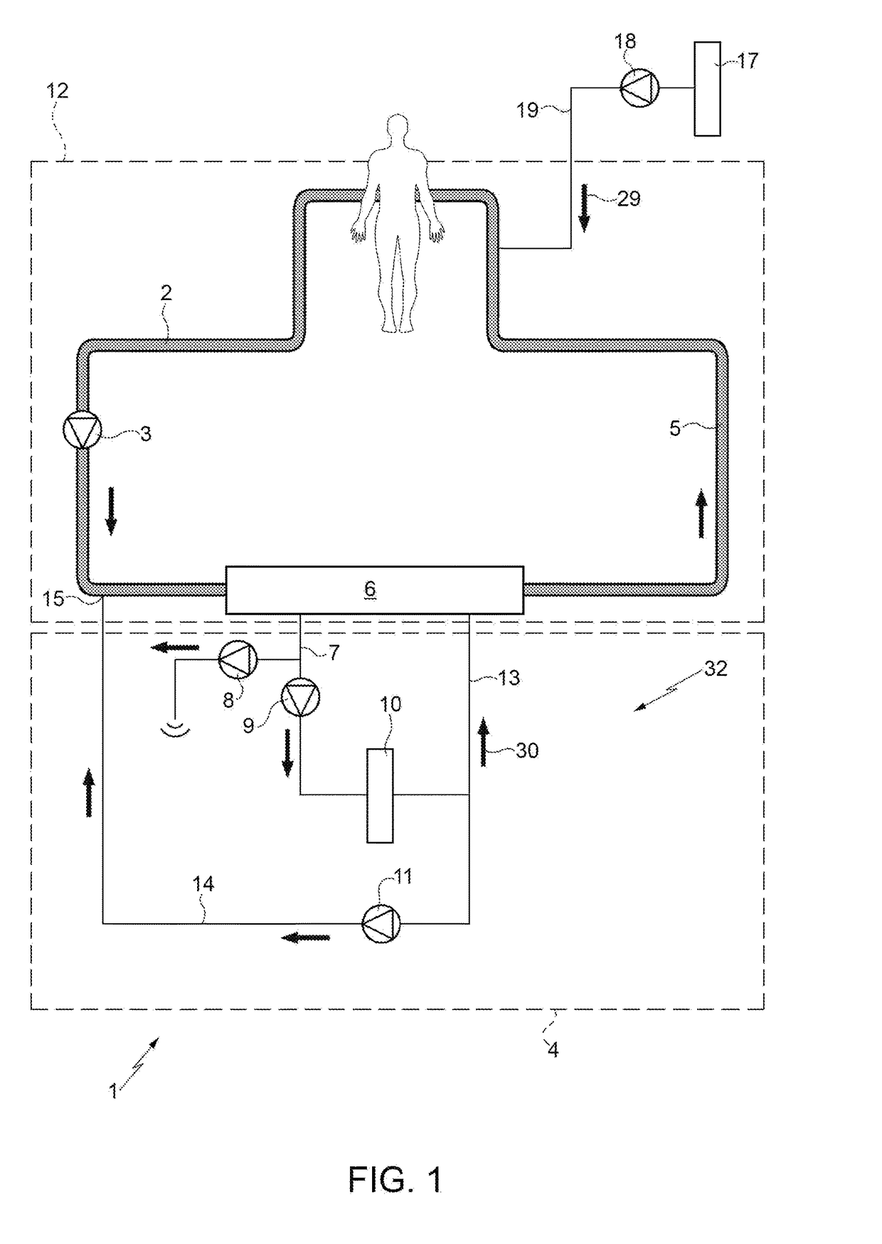 Regional s coagulation system for an extracorporeal circulation circuit