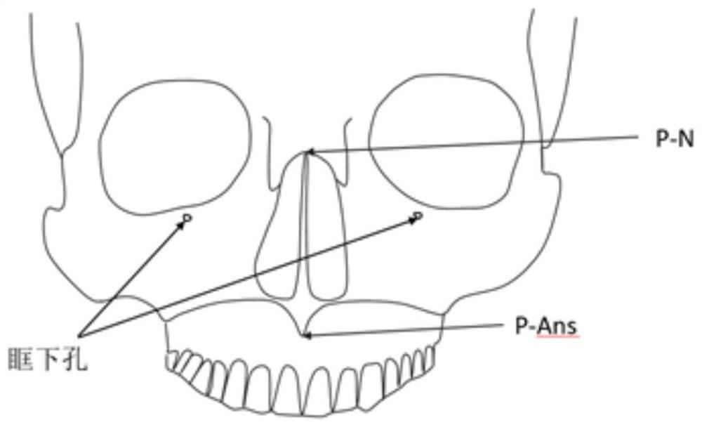 Transverse rotation axis positioning and extracting method for lower jawbone CBCT data