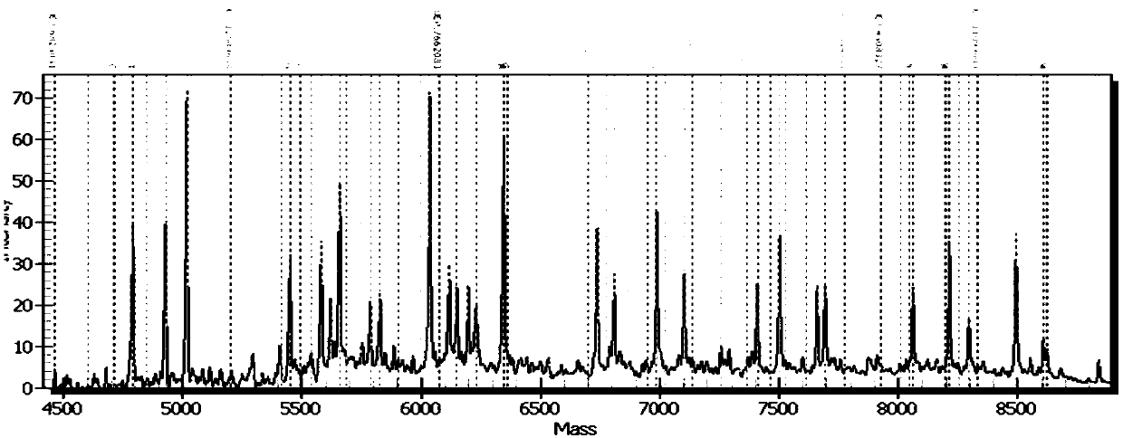 Primer composition for judging personalized medication type of captopril