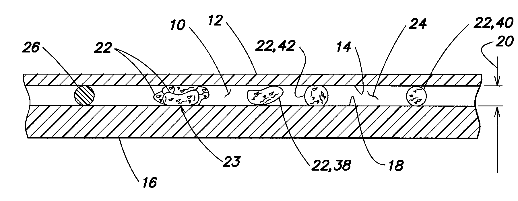 Method and apparatus for determining the hematocrit of a blood sample utilizing the intrinsic pigmentation of hemoglobin contained within the red blood cells