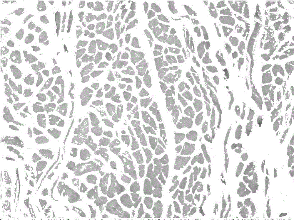 Application of SHARPIN gene in preparation of reagent for diagnosing human skin tumors