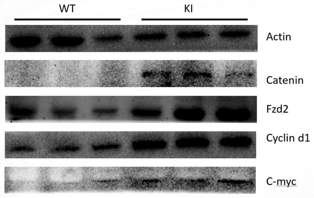 Application of wnt inhibitor wnt-c59 in preparation of medicine for scn5a mutation-induced dilated cardiomyopathy