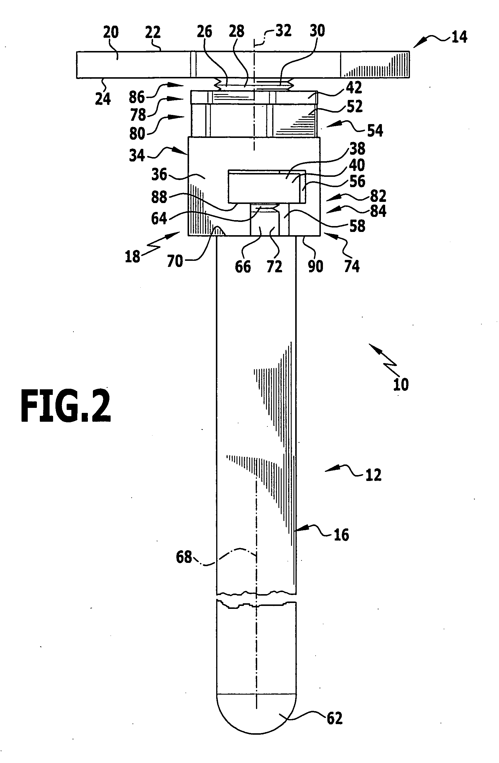 Modular implant part and knee joint prosthesis