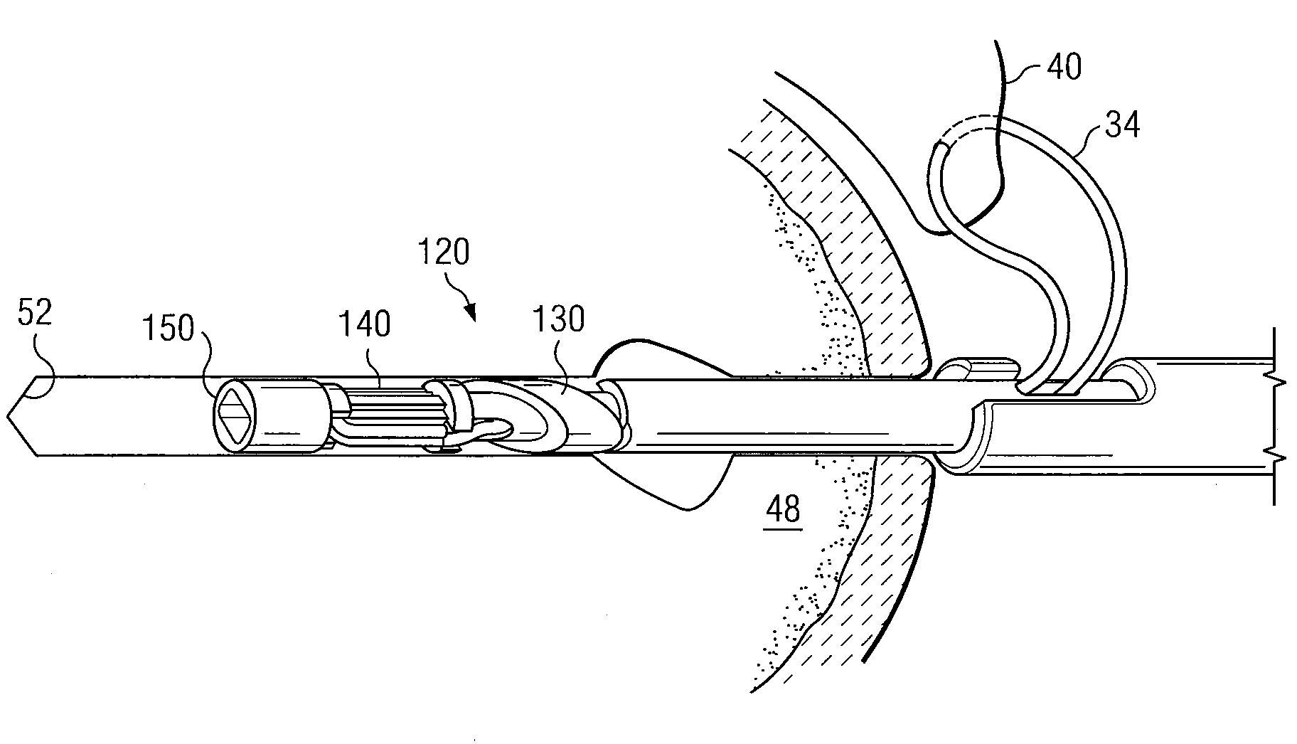 Knotless suture anchor having discrete polymer components and related methods