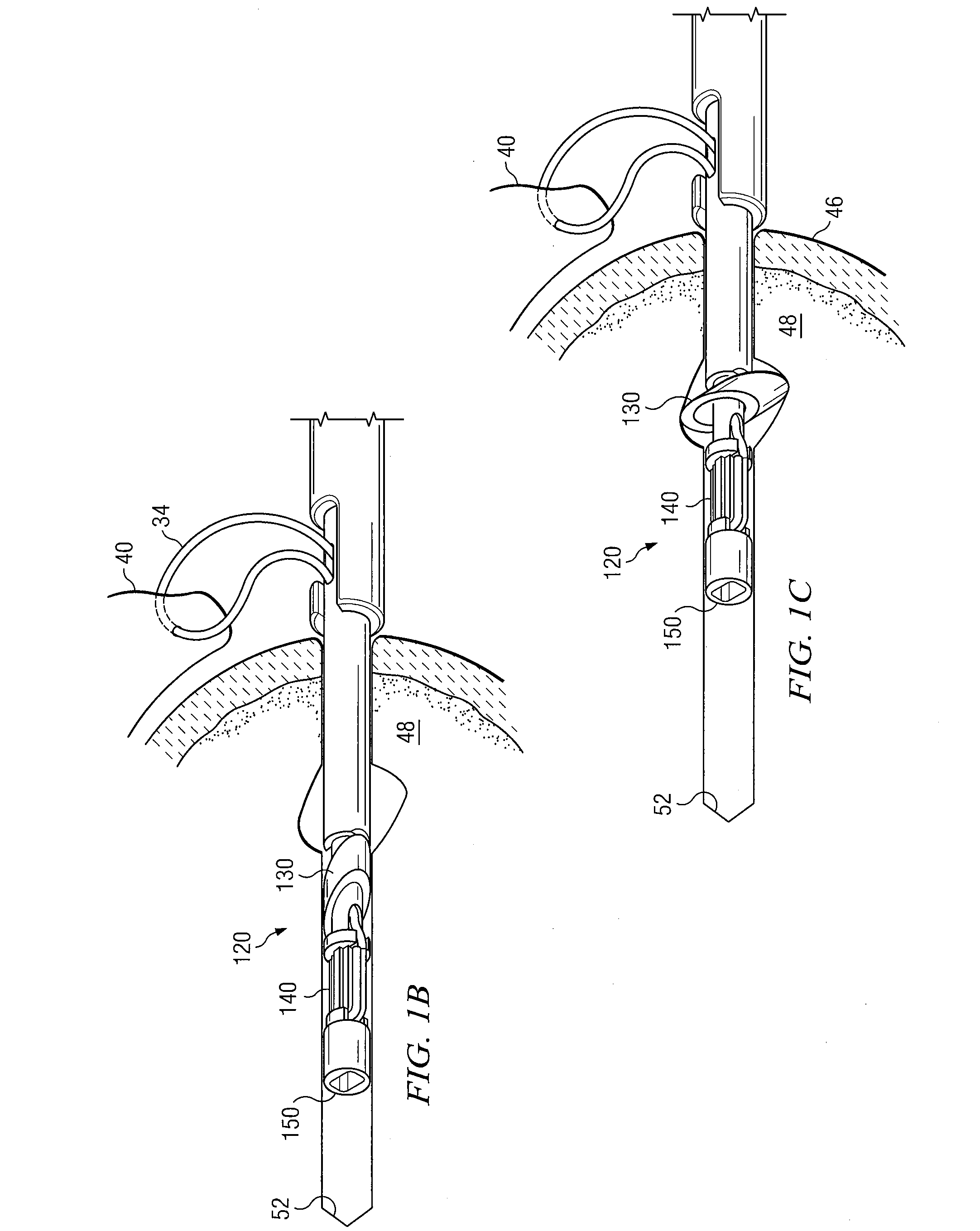 Knotless suture anchor having discrete polymer components and related methods