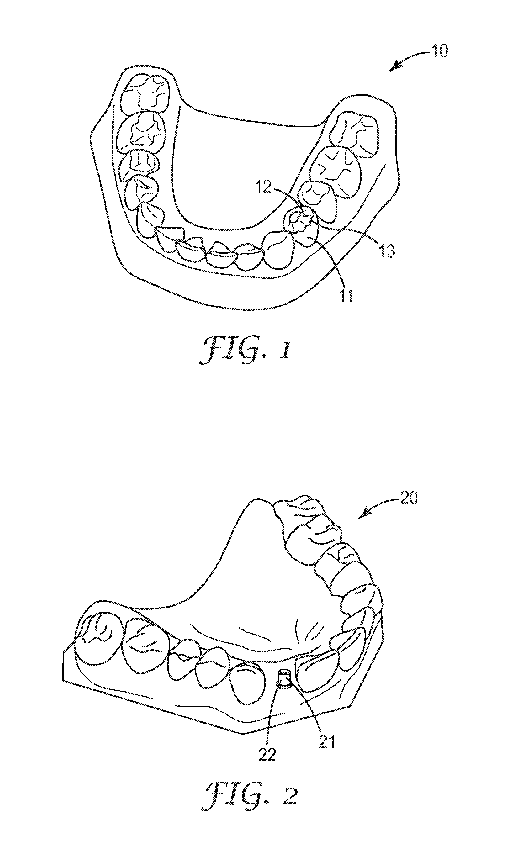 Method and system for making a dental restoration