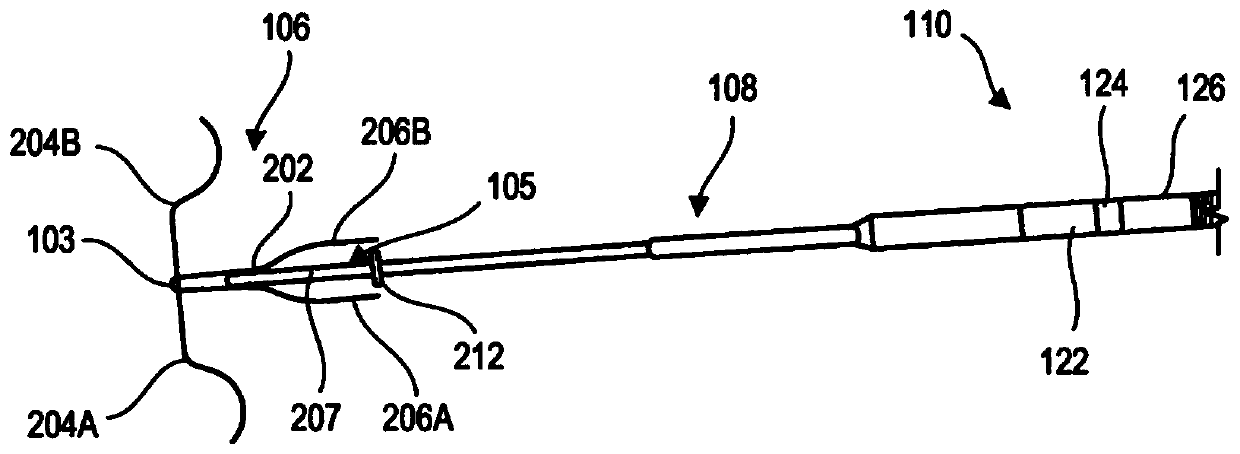 Adjustable heart valve implant