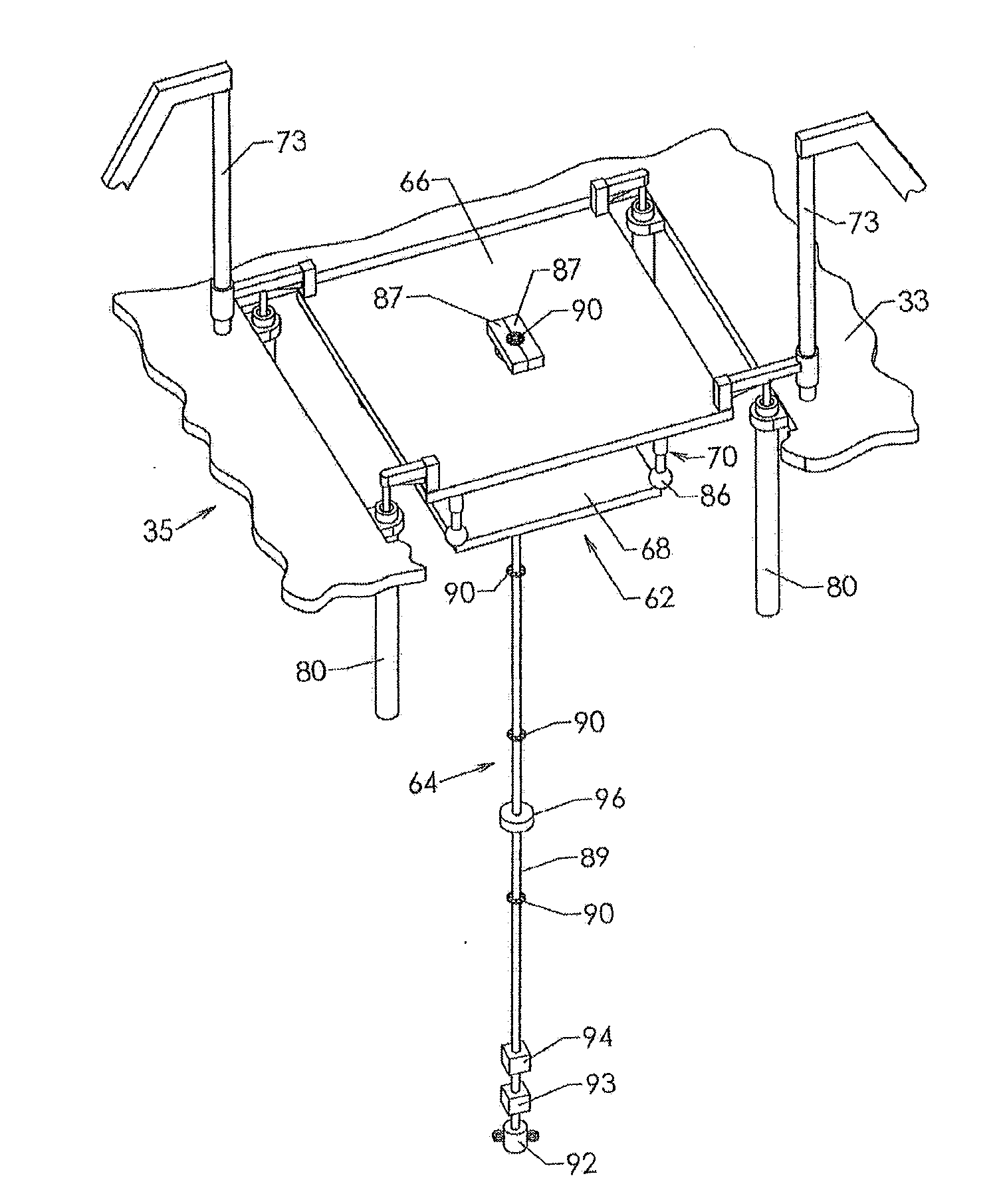 Downhole Intervention