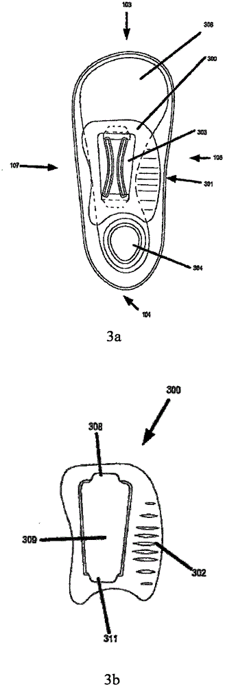 Intelligent osteoarthrosis correcting device