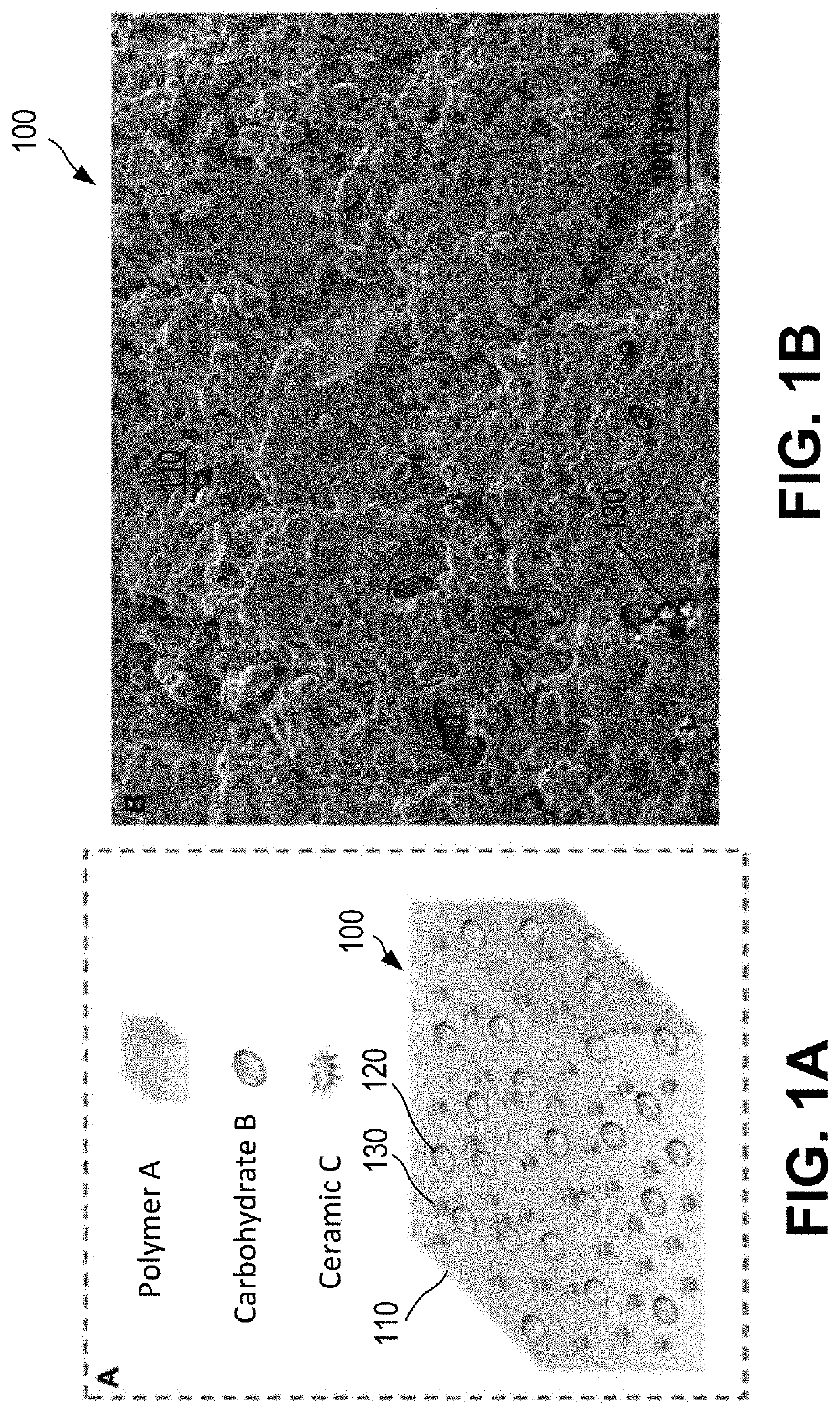 Bioresorbable implant with inside-out resorption for enhanced bone ingrowth and tissue integration and method of manufacturing thereof