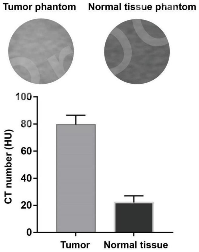 Tumor-bearing tissue model for US/CT-guided downlink tumor puncture or thermal ablation training and preparation method thereof