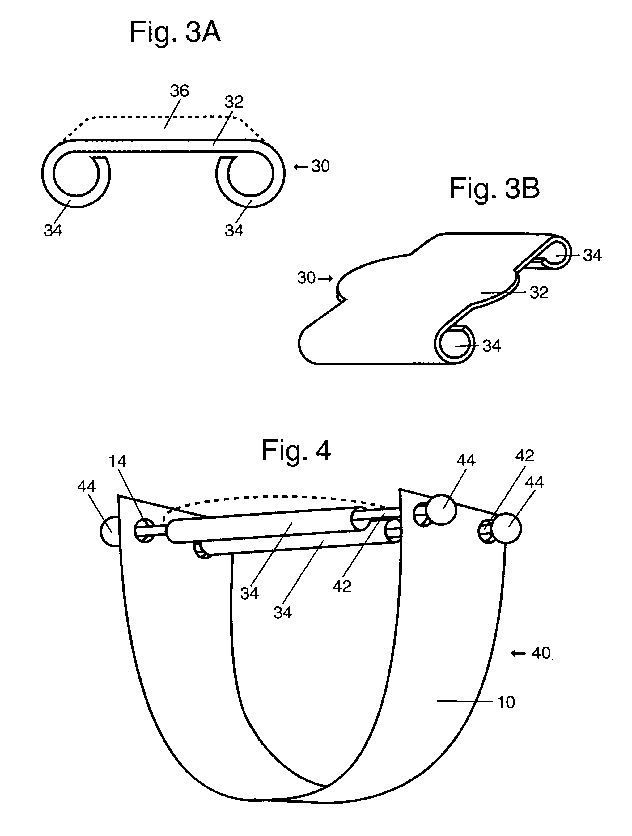 Ornamental ring and assembly method