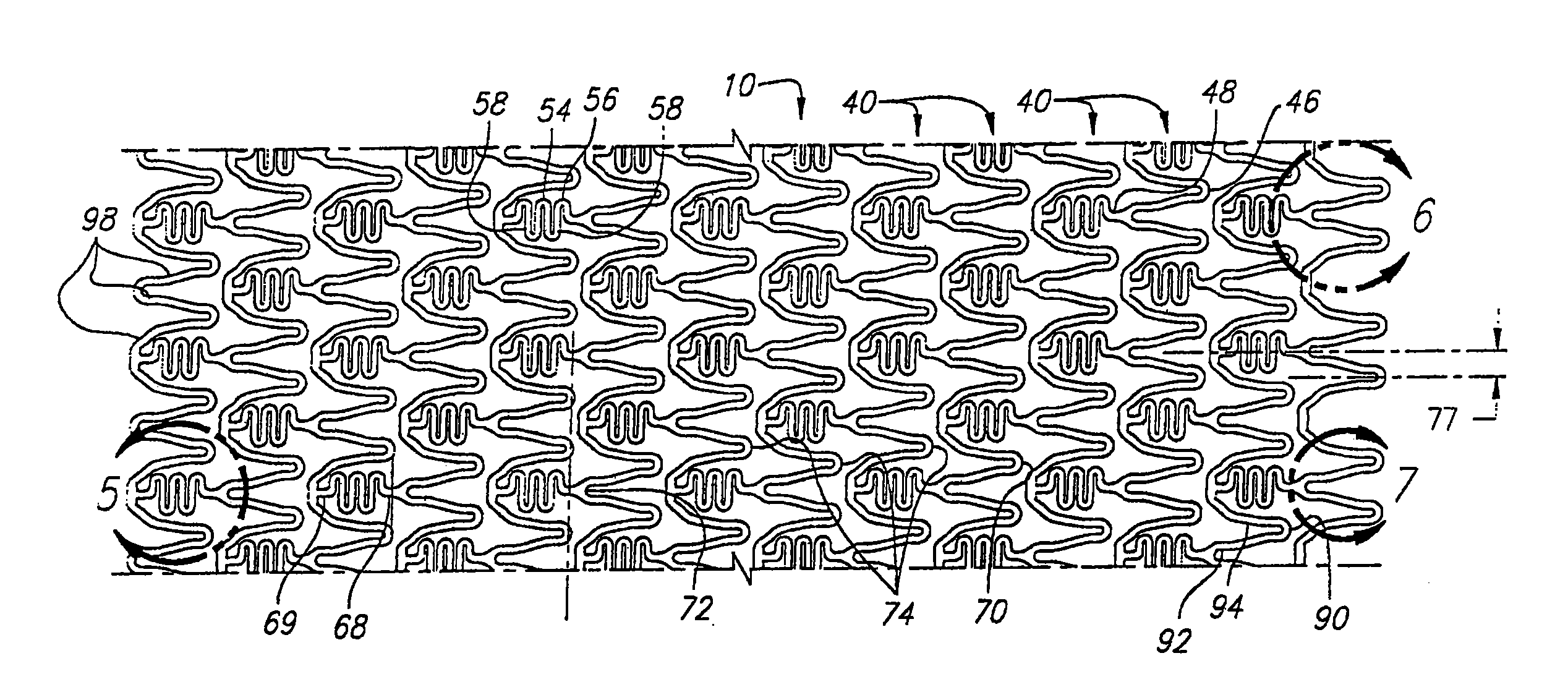 Intravascular stent