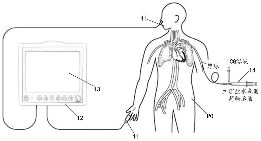 Detection method and device for effective effective hepatic blood flow, and storage medium